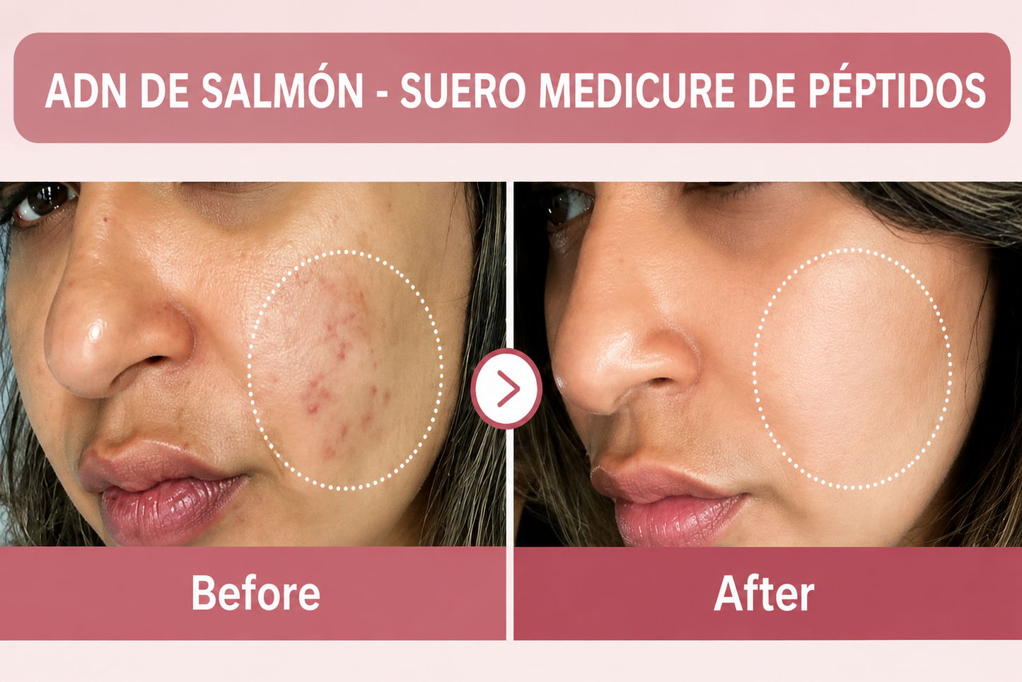 ADN DE SALMÓN - SUERO MEDICURE DE PÉPTIDOS